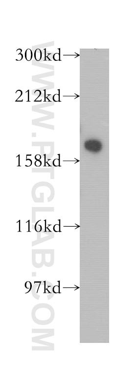 Western Blot (WB) analysis of HeLa cells using DISP1 Polyclonal antibody (12041-1-AP)