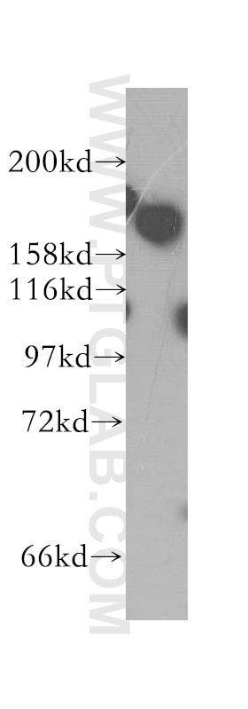 Western Blot (WB) analysis of HEK-293 cells using DISP1 Polyclonal antibody (12041-1-AP)