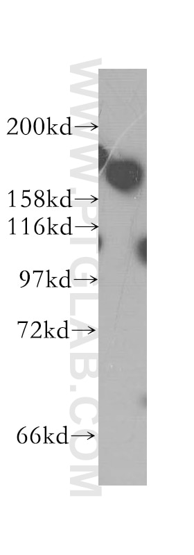 WB analysis of HEK-293 using 12041-1-AP