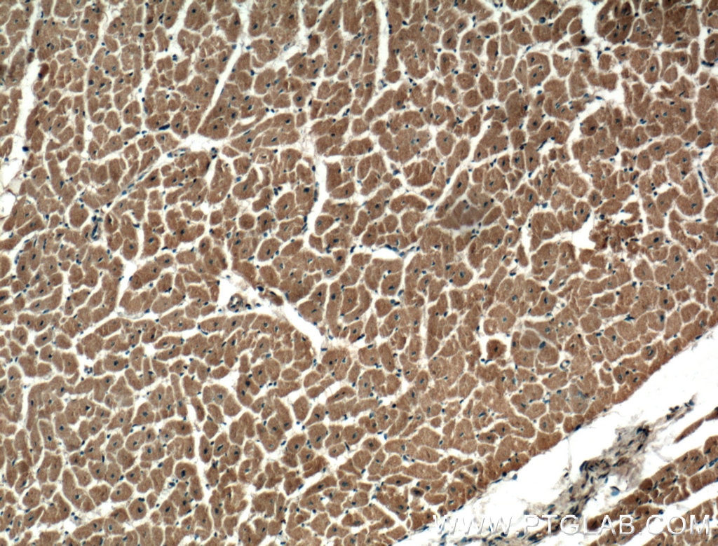 Immunohistochemistry (IHC) staining of human heart tissue using DIXDC1 Polyclonal antibody (13816-1-AP)
