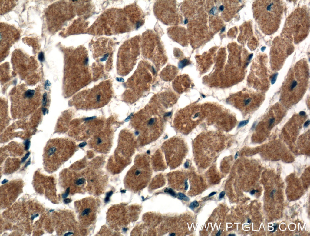 Immunohistochemistry (IHC) staining of human heart tissue using DIXDC1 Polyclonal antibody (13816-1-AP)