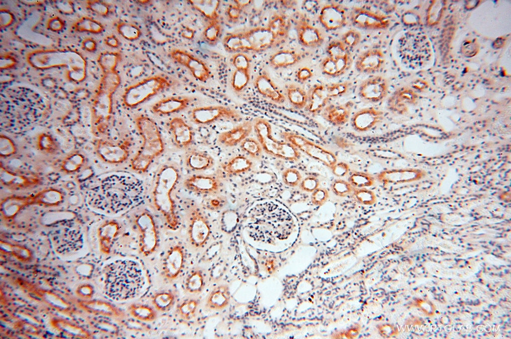 Immunohistochemistry (IHC) staining of human kidney tissue using DIXDC1 Polyclonal antibody (13816-1-AP)