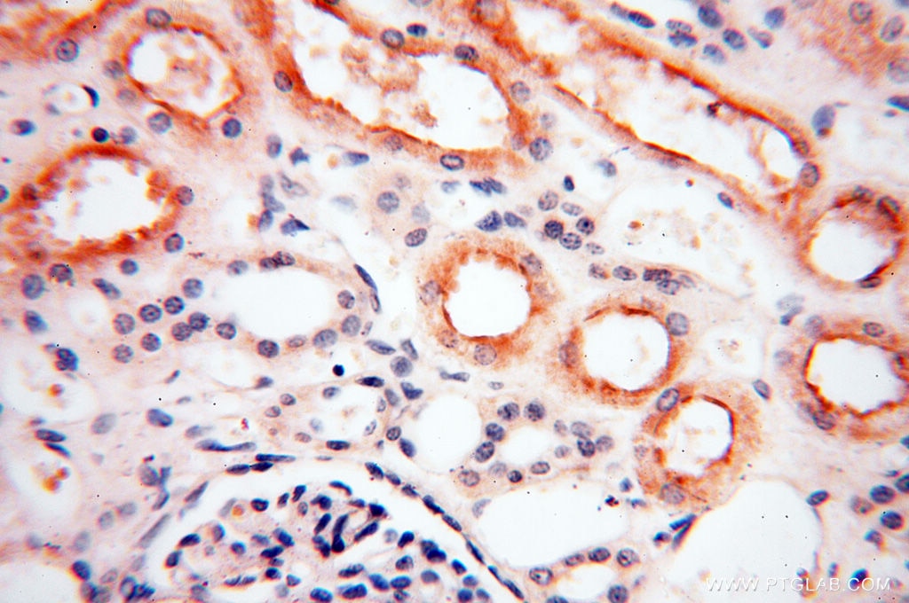 Immunohistochemistry (IHC) staining of human kidney tissue using DIXDC1 Polyclonal antibody (13816-1-AP)