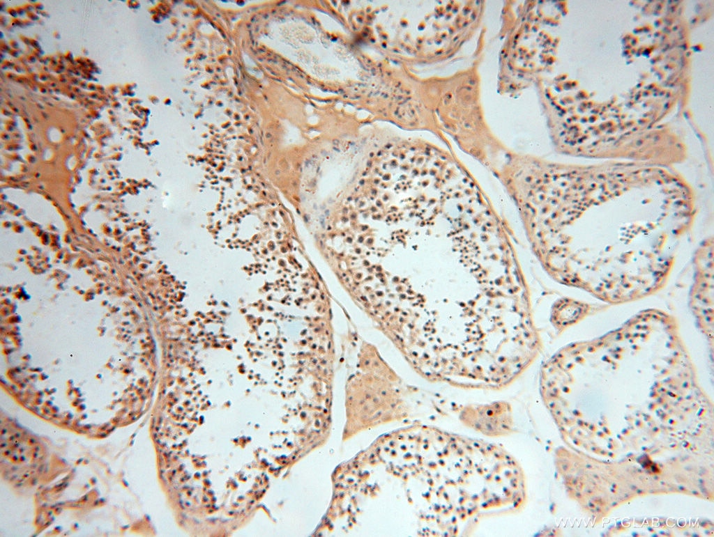 Immunohistochemistry (IHC) staining of human testis tissue using DIXDC1 Polyclonal antibody (13816-1-AP)