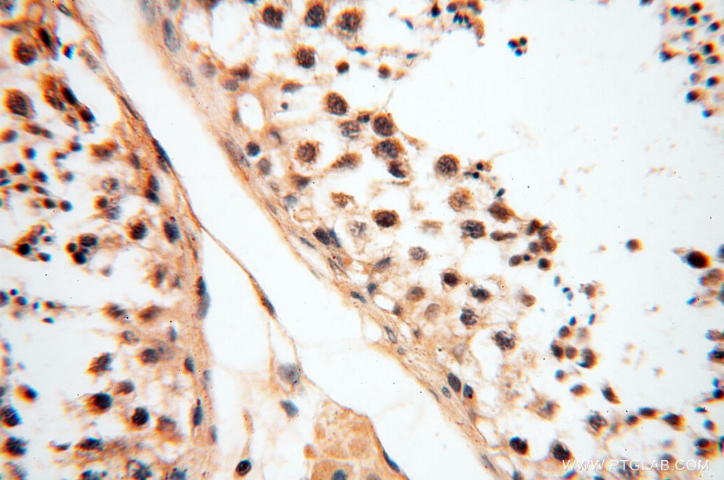 Immunohistochemistry (IHC) staining of human testis tissue using DIXDC1 Polyclonal antibody (13816-1-AP)