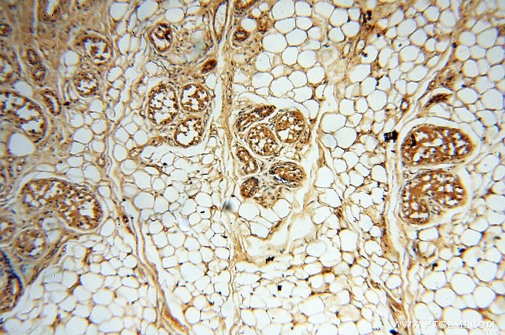 Immunohistochemistry (IHC) staining of human skin tissue using DIXDC1 Polyclonal antibody (13816-1-AP)