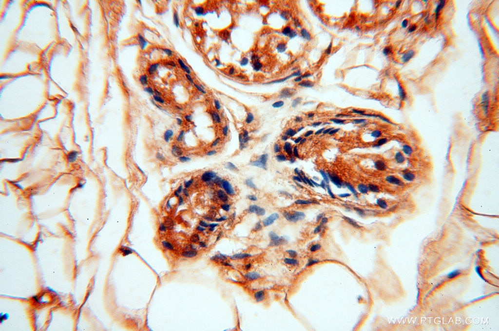 Immunohistochemistry (IHC) staining of human skin tissue using DIXDC1 Polyclonal antibody (13816-1-AP)