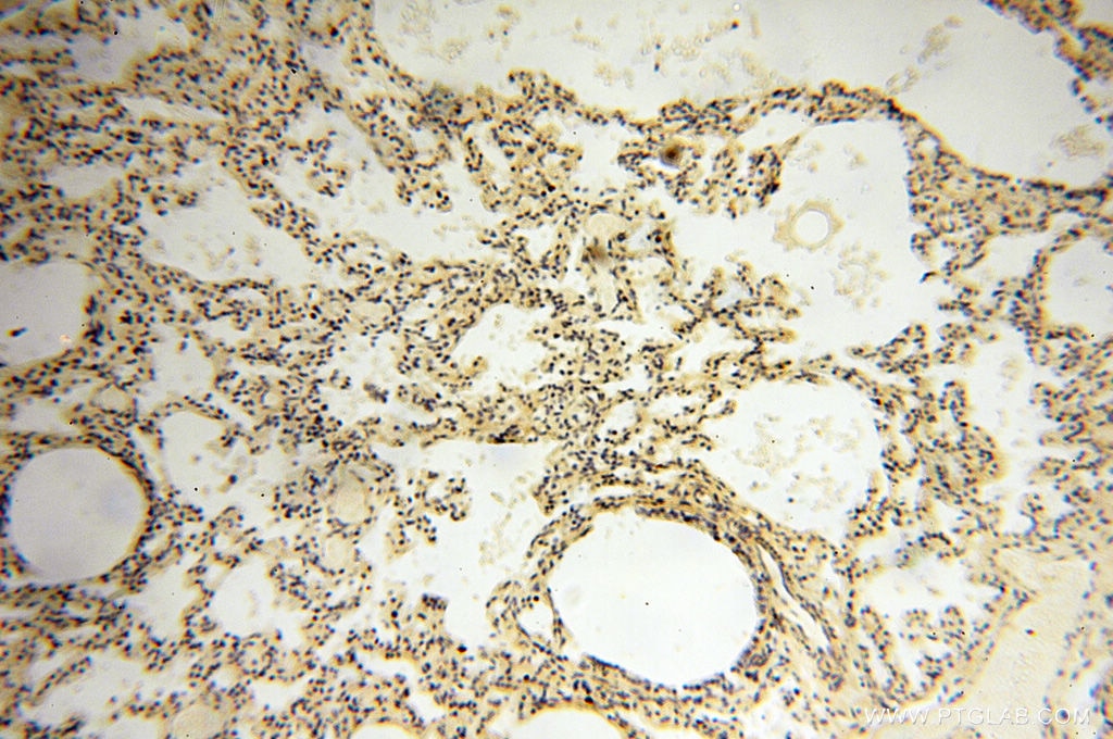 Immunohistochemistry (IHC) staining of human lung tissue using DIXDC1 Polyclonal antibody (13816-1-AP)