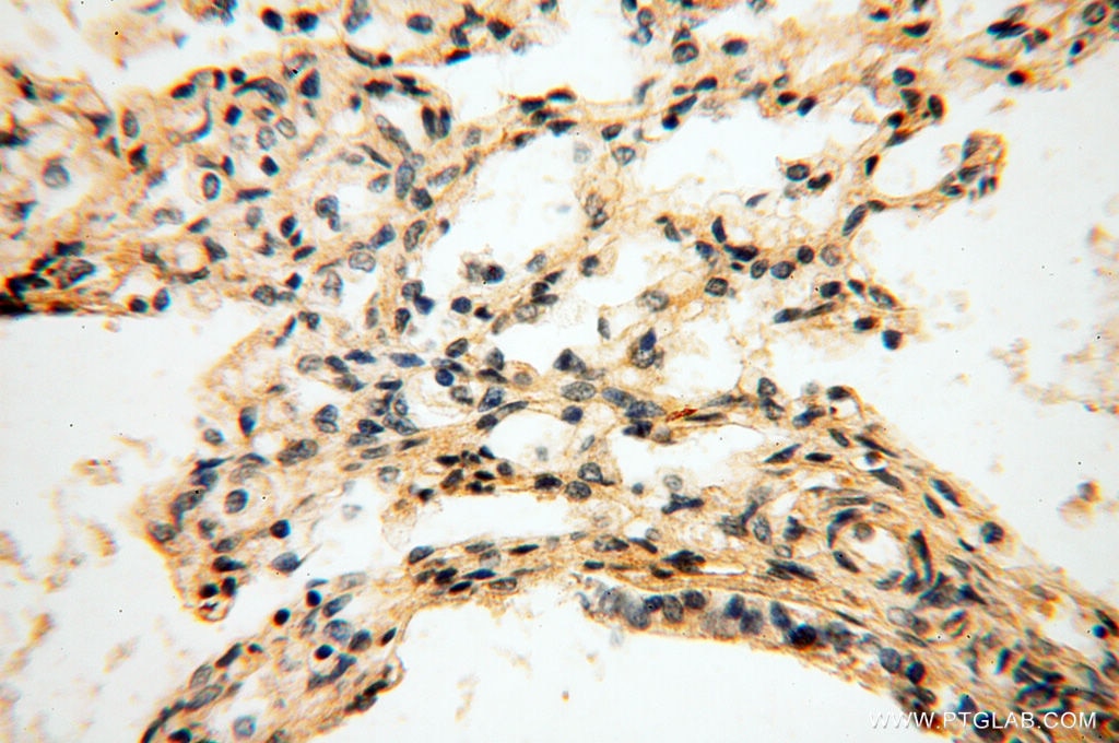 Immunohistochemistry (IHC) staining of human lung tissue using DIXDC1 Polyclonal antibody (13816-1-AP)