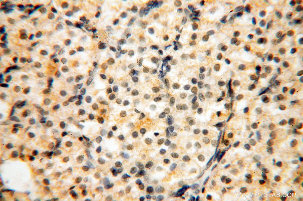 Immunohistochemistry (IHC) staining of human ovary tissue using DIXDC1 Polyclonal antibody (13816-1-AP)