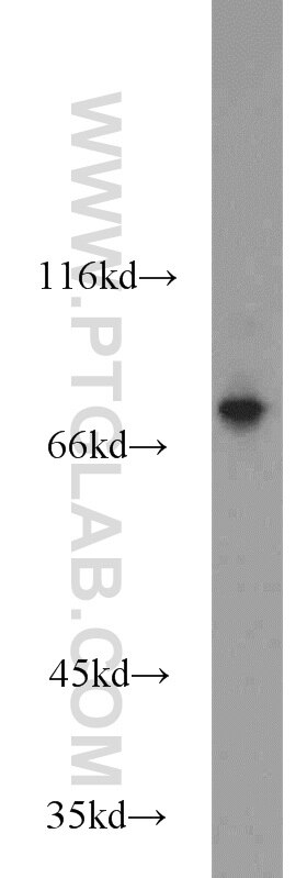 Western Blot (WB) analysis of mouse skeletal muscle tissue using DIXDC1 Polyclonal antibody (13816-1-AP)