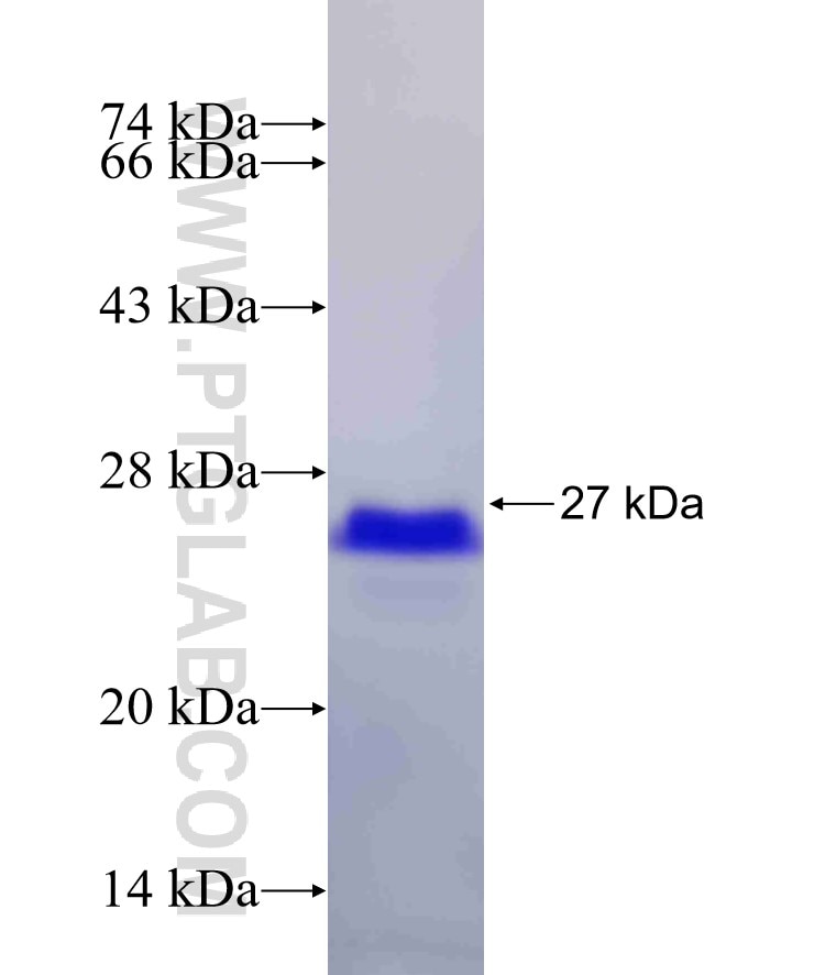 DIXDC1 fusion protein Ag31523 SDS-PAGE DIXDC1 fusion protein Ag31523 SDS-PAGE