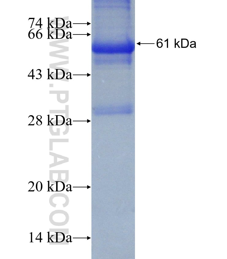 DIXDC1 fusion protein Ag4904 SDS-PAGE