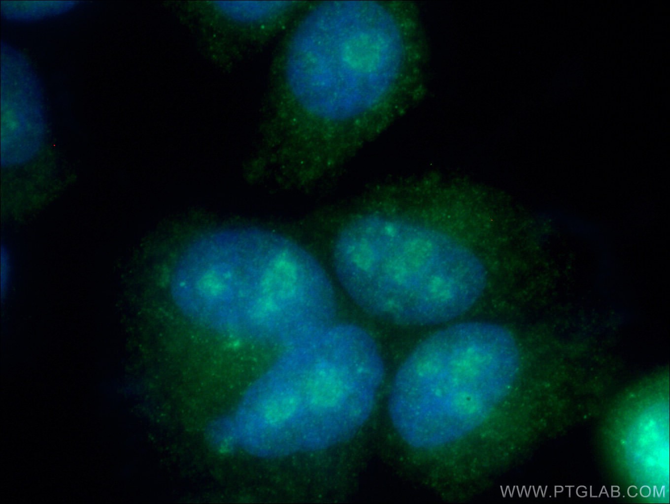 Immunofluorescence (IF) / fluorescent staining of HepG2 cells using DKC1 Polyclonal antibody (25420-1-AP)