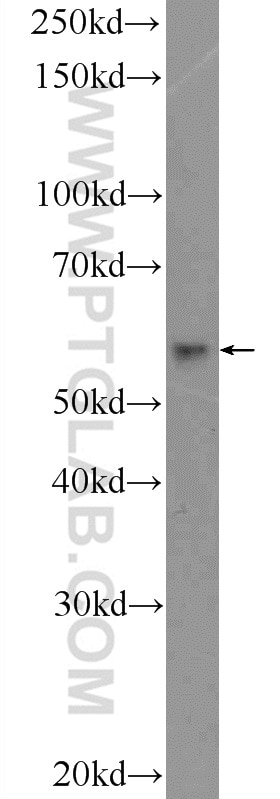 Western Blot (WB) analysis of MCF-7 cells using DKC1 Polyclonal antibody (25420-1-AP)