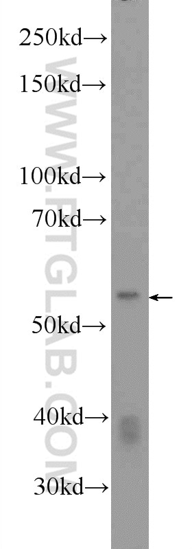 Western Blot (WB) analysis of Jurkat cells using DKC1 Polyclonal antibody (25420-1-AP)