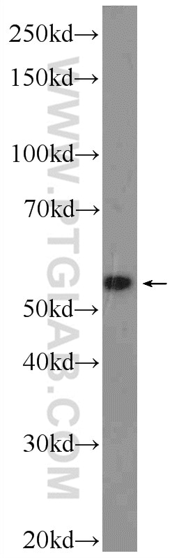 Western Blot (WB) analysis of COLO 320 cells using DKC1 Polyclonal antibody (25420-1-AP)