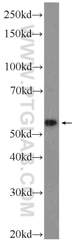 WB analysis of COLO 320 using 25420-1-AP