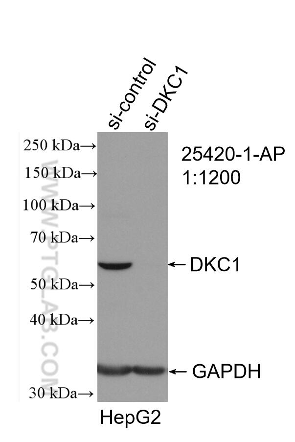 Western Blot (WB) analysis of HepG2 cells using DKC1 Polyclonal antibody (25420-1-AP)