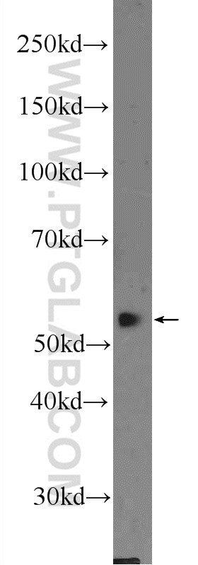 Western Blot (WB) analysis of HeLa cells using DKC1 Polyclonal antibody (25420-1-AP)