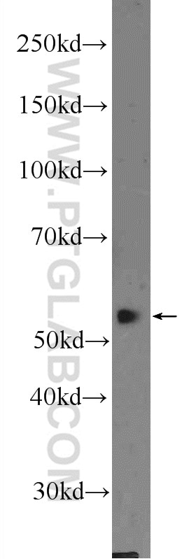 WB analysis of HeLa using 25420-1-AP