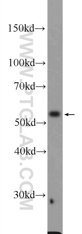 Western Blot (WB) analysis of HepG2 cells using DKC1 Polyclonal antibody (25420-1-AP)