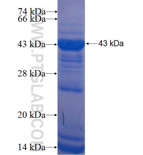 DKC1 fusion protein Ag7992 SDS-PAGE