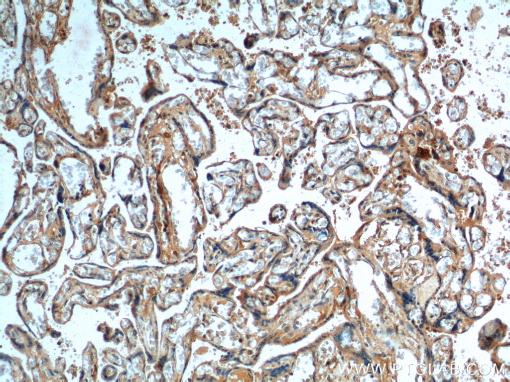Immunohistochemistry (IHC) staining of human placenta tissue using DKK1 Polyclonal antibody (21112-1-AP)