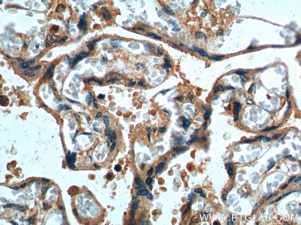 Immunohistochemistry (IHC) staining of human placenta tissue using DKK1 Polyclonal antibody (21112-1-AP)