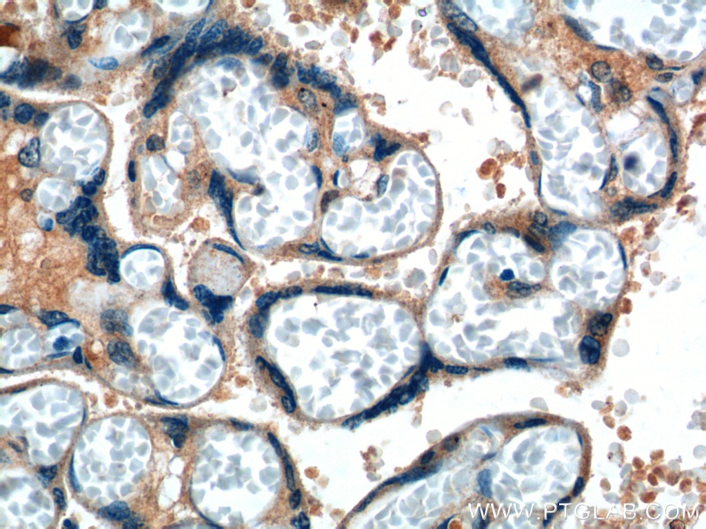 Immunohistochemistry (IHC) staining of human placenta tissue using DKK1 Polyclonal antibody (21112-1-AP)