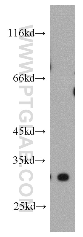 DKK1 Polyclonal antibody