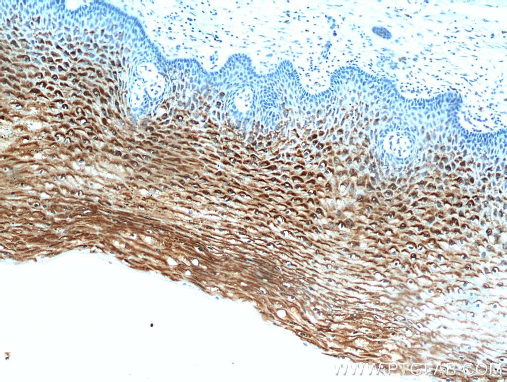 Immunohistochemistry (IHC) staining of human cervix tissue using DKK2 Polyclonal antibody (21051-1-AP)