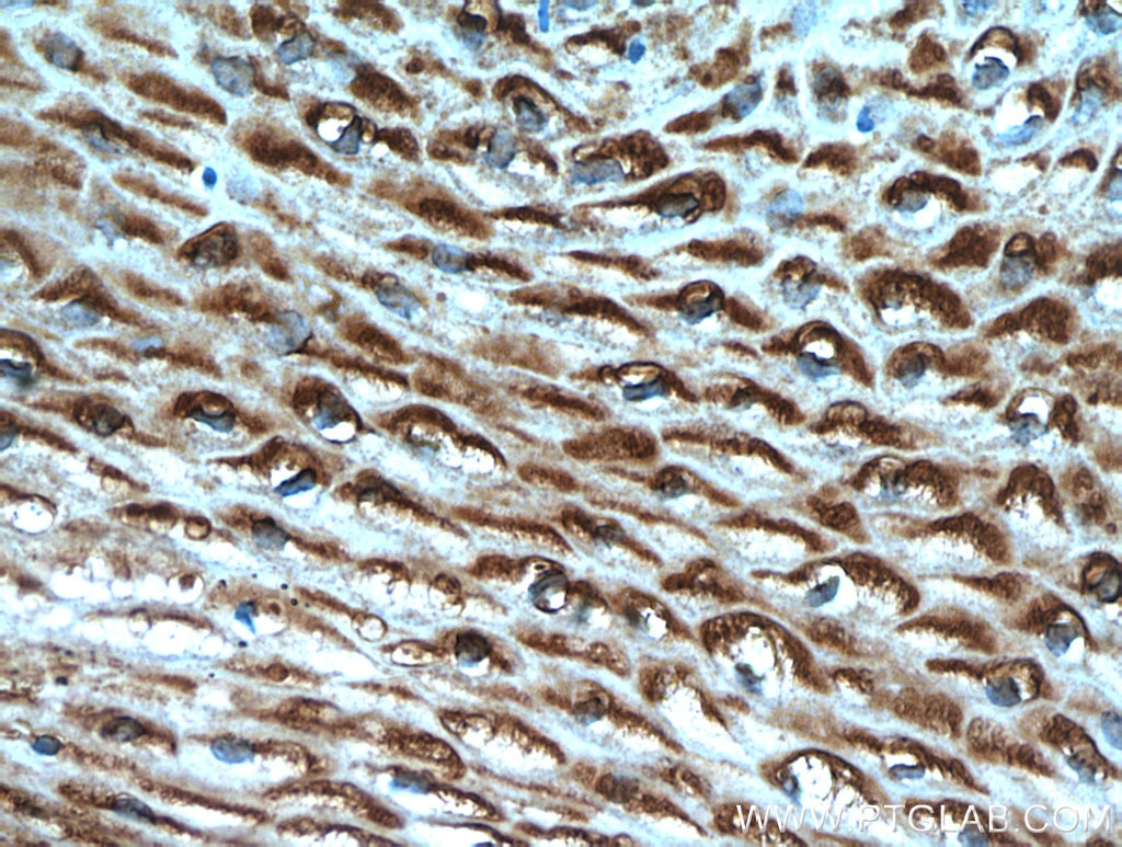 DKK2 Polyclonal antibody