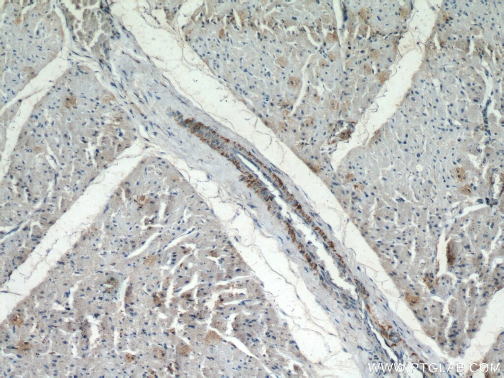 IHC staining of human heart using 21051-1-AP