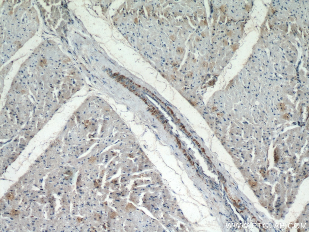 Immunohistochemistry (IHC) staining of human heart tissue using DKK2 Polyclonal antibody (21051-1-AP)