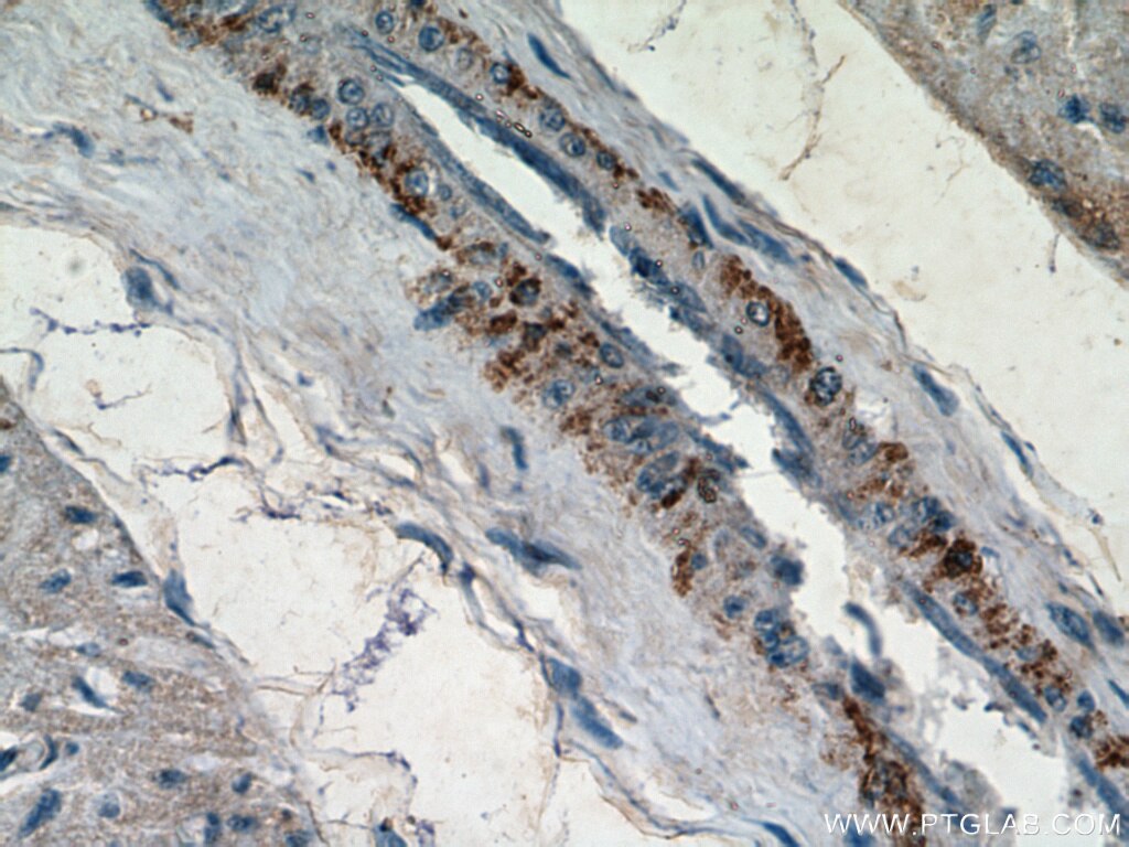 Immunohistochemistry (IHC) staining of human heart tissue using DKK2 Polyclonal antibody (21051-1-AP)