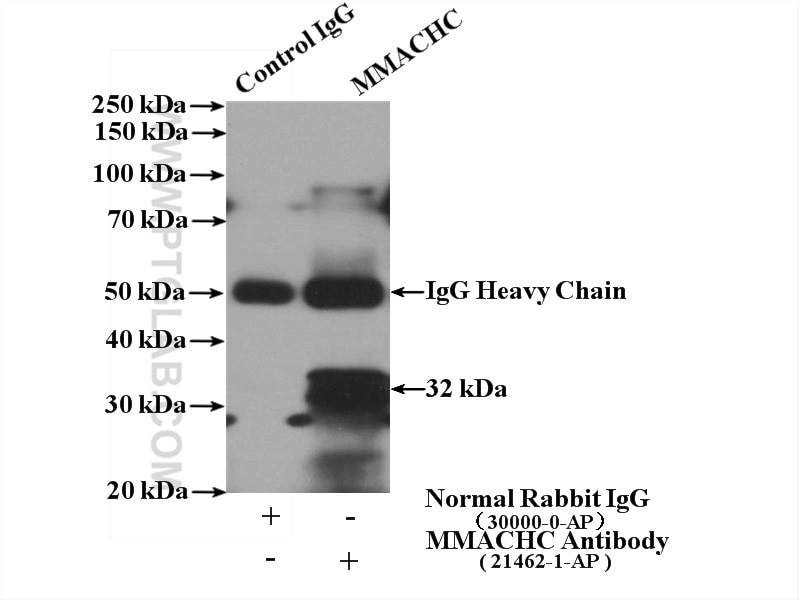 Immunoprecipitation (IP) experiment of mouse skeletal muscle tissue using DKK2 Polyclonal antibody (21051-1-AP)