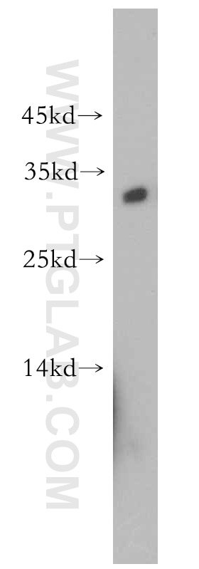 Western Blot (WB) analysis of mouse skeletal muscle tissue using DKK2 Polyclonal antibody (21051-1-AP)