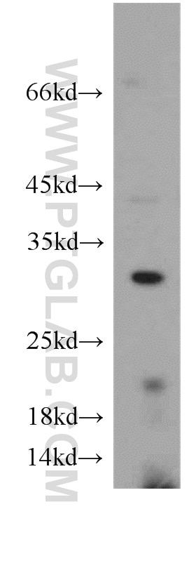 Western Blot (WB) analysis of mouse skeletal muscle tissue using DKK2 Polyclonal antibody (21051-1-AP)