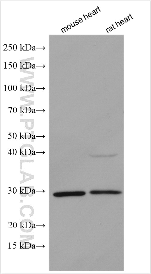 Western Blot (WB) analysis of various lysates using DKK2 Polyclonal antibody (29023-1-AP)