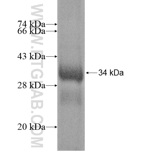 DKK2 fusion protein Ag12405 SDS-PAGE