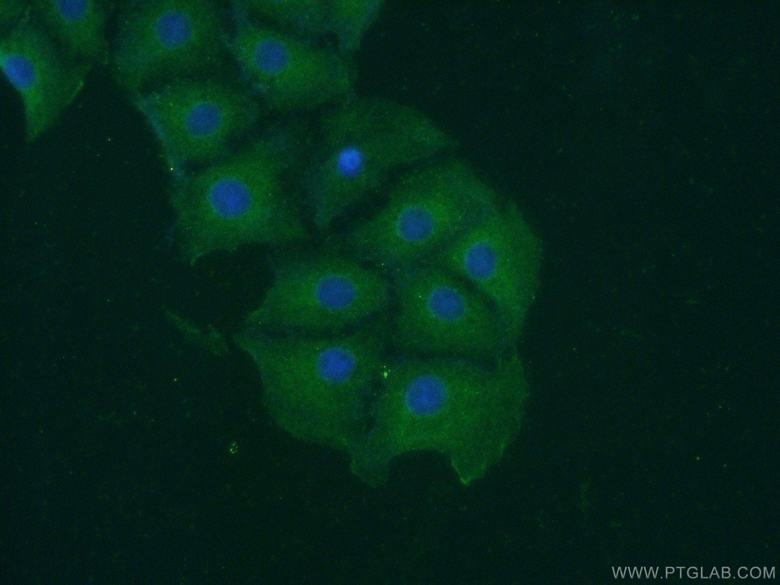 Immunofluorescence (IF) / fluorescent staining of SH-SY5Y cells using DKK3 Polyclonal antibody (10365-1-AP)