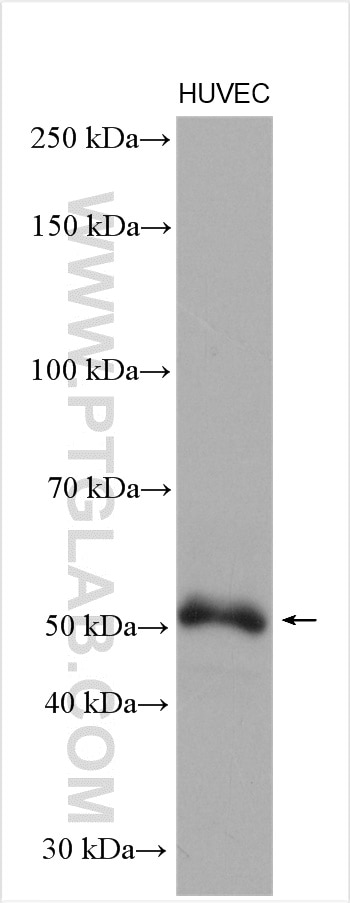 Western Blot (WB) analysis of HUVEC cells using DKK3 Polyclonal antibody (10365-1-AP)