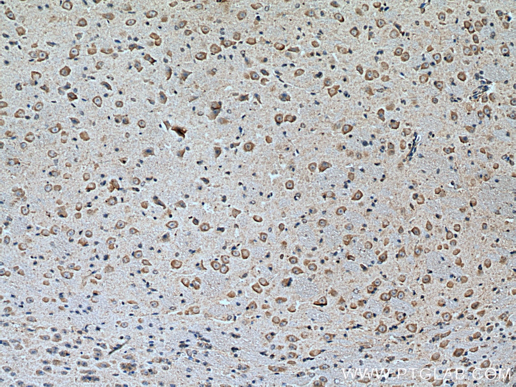 Immunohistochemistry (IHC) staining of mouse brain tissue using DKK3 Monoclonal antibody (66758-1-Ig)
