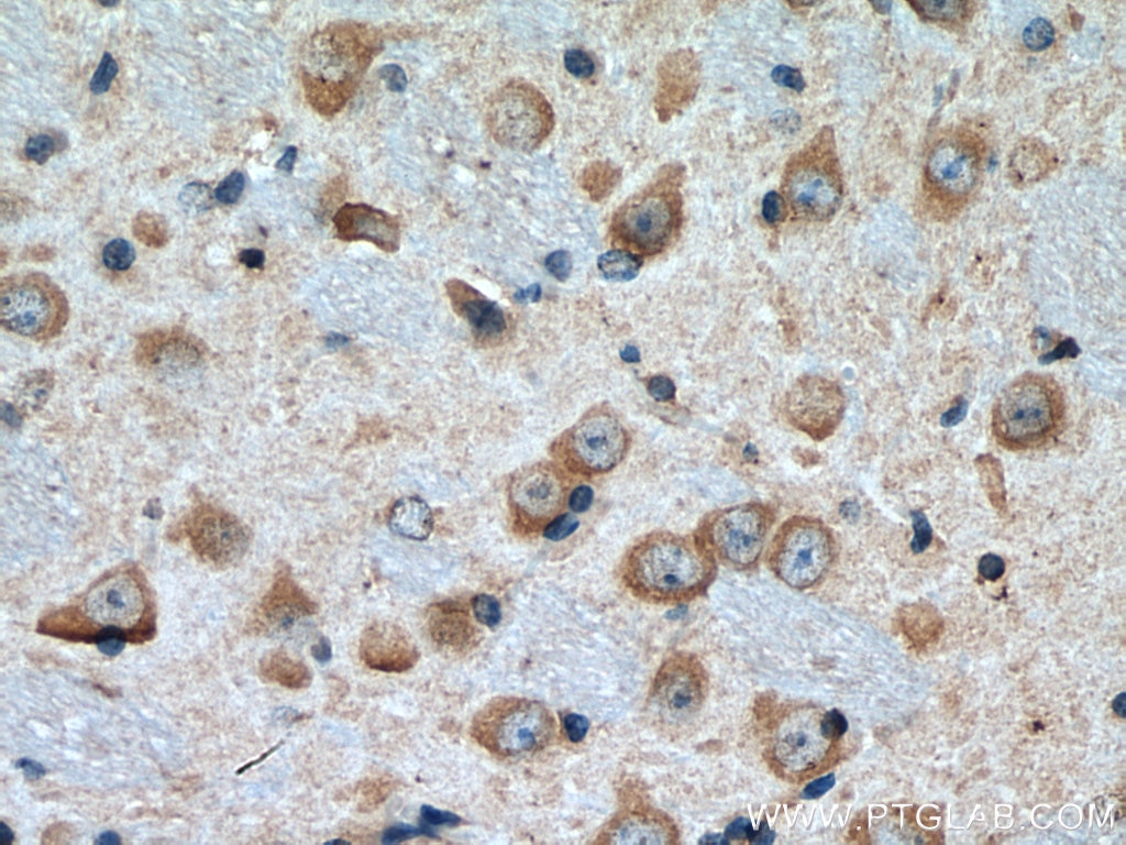 Immunohistochemistry (IHC) staining of mouse brain tissue using DKK3 Monoclonal antibody (66758-1-Ig)