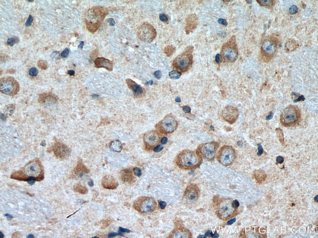 IHC staining of mouse brain using 66758-1-Ig