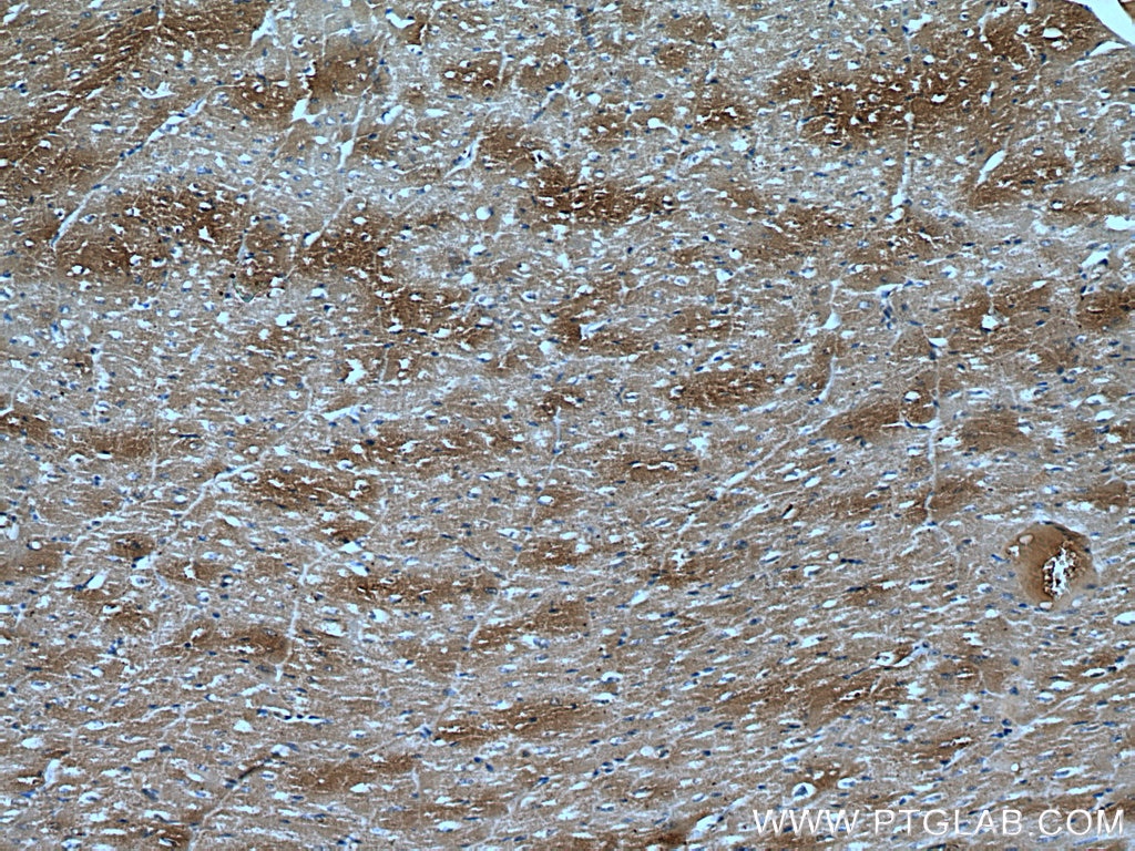 Immunohistochemistry (IHC) staining of human heart tissue using DKK3 Monoclonal antibody (66758-1-Ig)