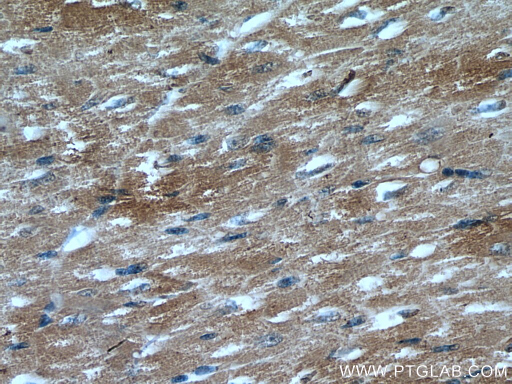 Immunohistochemistry (IHC) staining of human heart tissue using DKK3 Monoclonal antibody (66758-1-Ig)