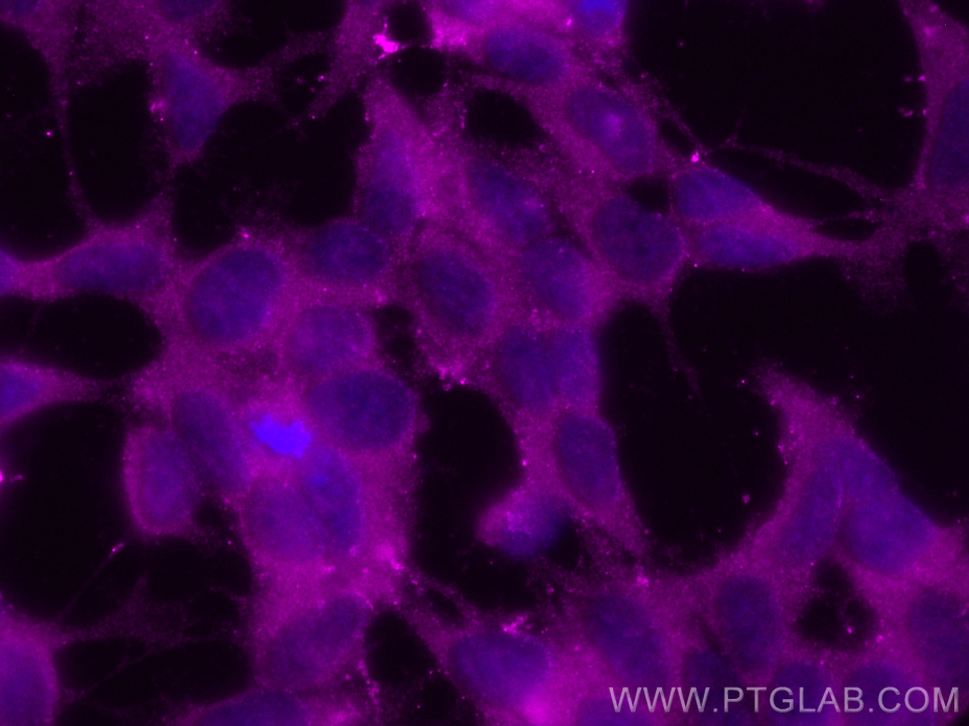 Immunofluorescence (IF) / fluorescent staining of SH-SY5Y cells using CoraLite® Plus 647-conjugated DKK3 Polyclonal anti (CL647-10365)