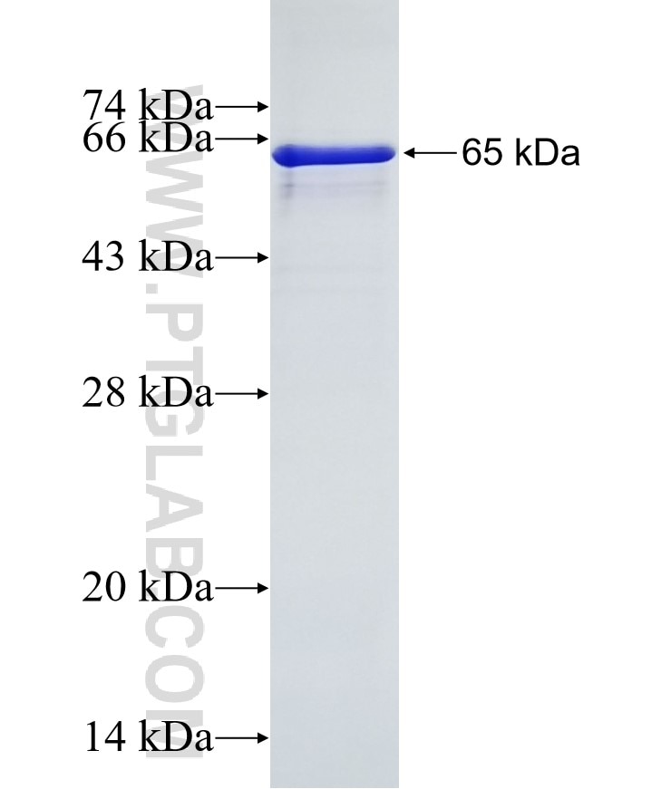 DKK3 fusion protein Ag0417 SDS-PAGE